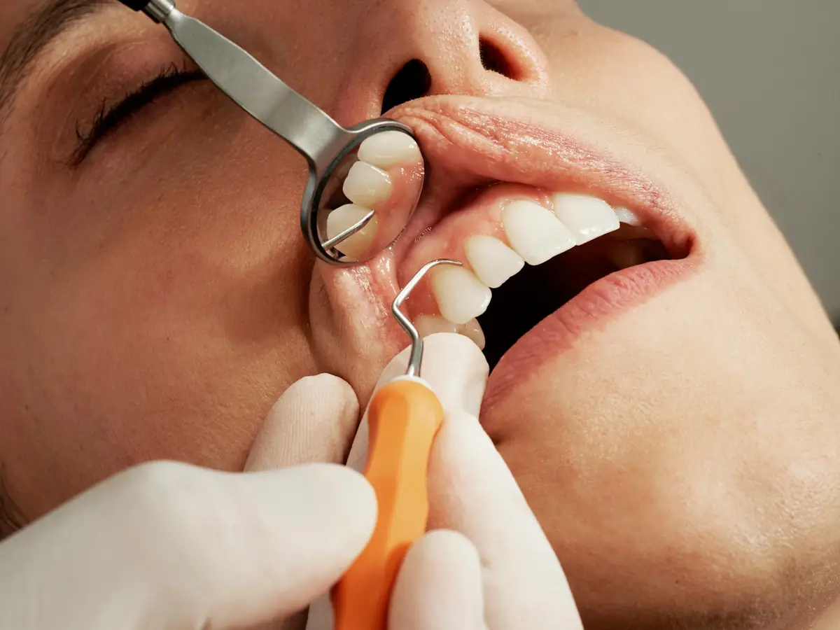 A dentist checking a patient's teeth with a mirror and probe